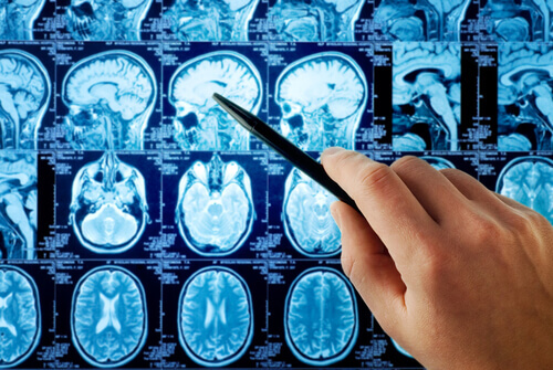 cerebro-viciado-em-sexo