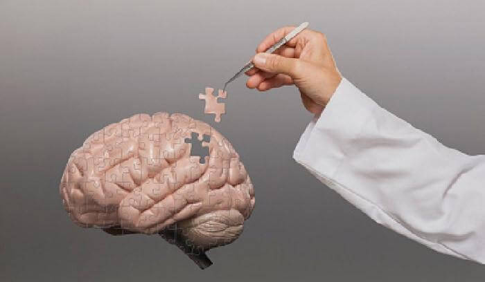 cerebro