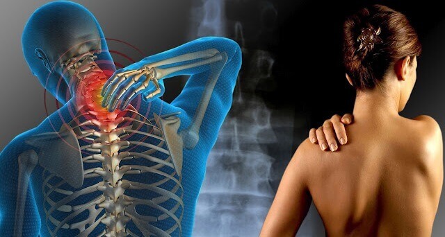 dores-da-fibromialgia