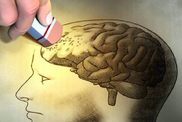 cerebro-demencia