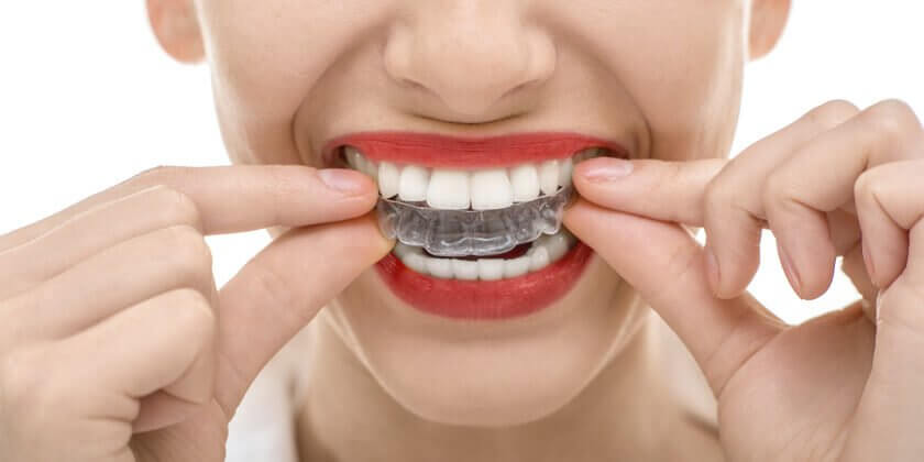 como-controlar-bruxismo