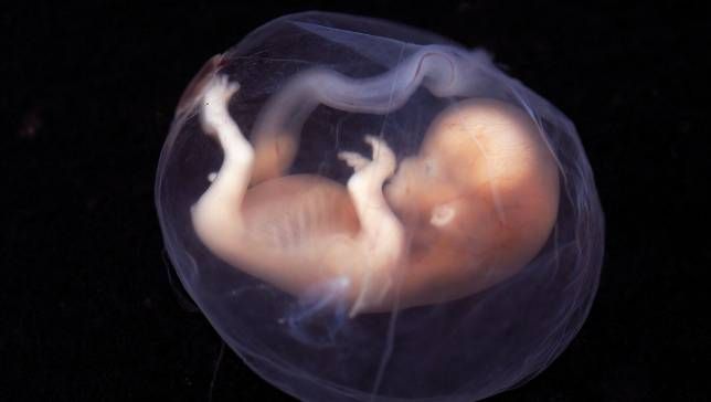 feto-humano