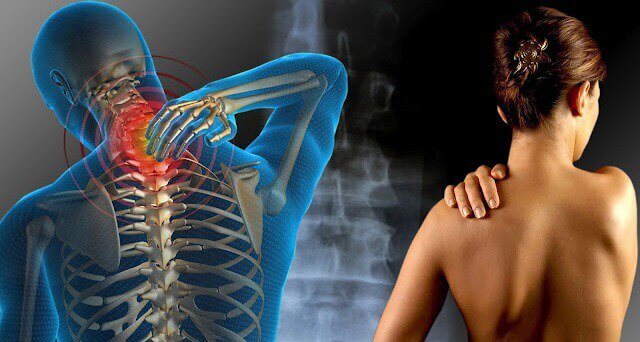 Fibromialgia