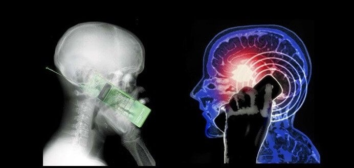 Os aparelhos eletrônicos afetam nosso cérebro