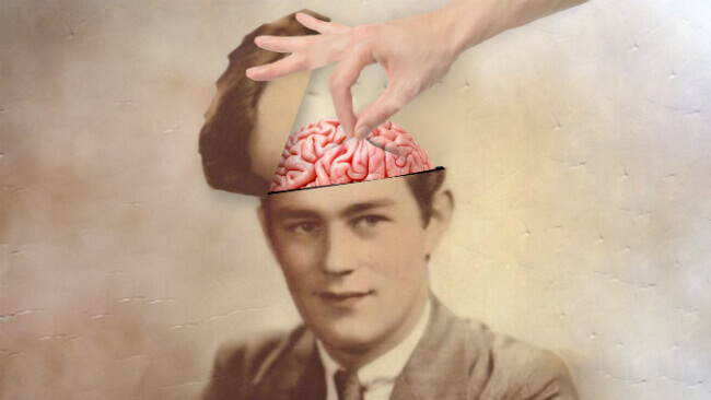 Homem com cabeça aberta e cérebro à mostra