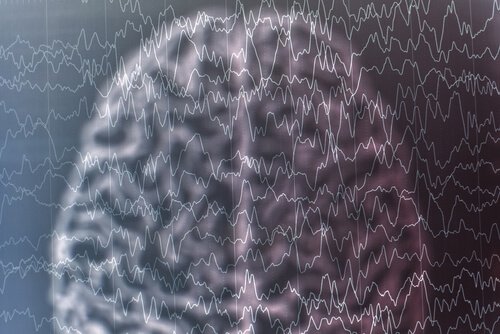 cerebro-com-desenho-de-ondas Síndrome de Lennox-Gastaut