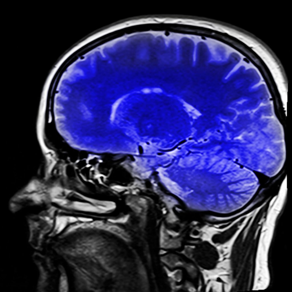 Cérebro humano pintado de azul