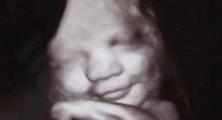 Bebê sorrindo no útero
