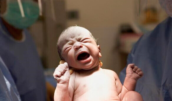 Bebê logo depois de nascer