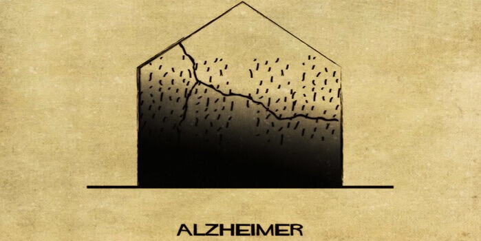 Alzheimer