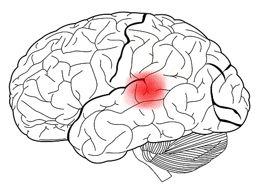A área de Wernicke no cérebro