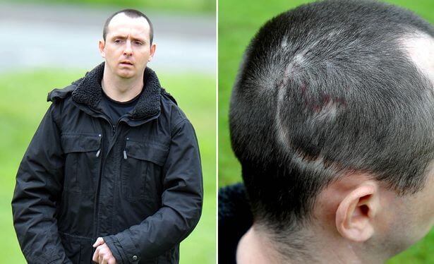 Riso patológico: conheça o interessante caso de Paul Pugh