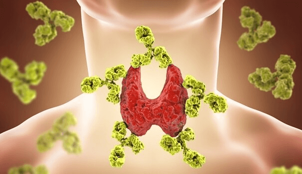 Distúrbio na tireoide