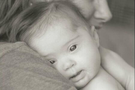 Bebê com síndrome de Down