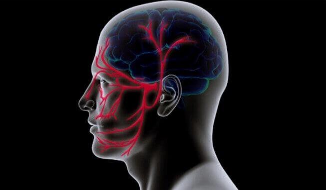 Neuralgia do trigêmeo