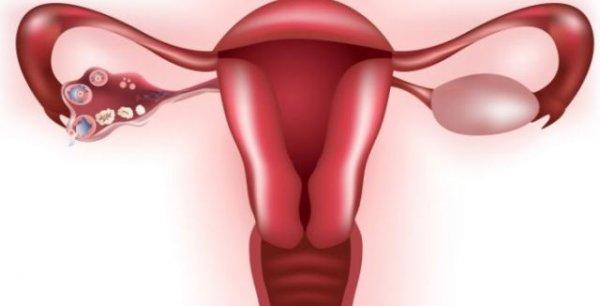 Cistos ovarianos