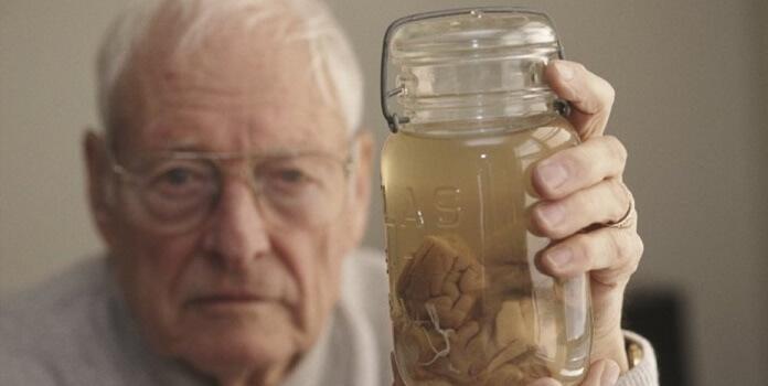 A história do cérebro de Albert Einstein