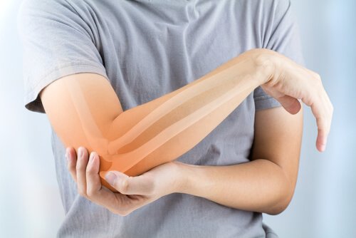 Artrite reumatoide: sintomas, causas e tratamento