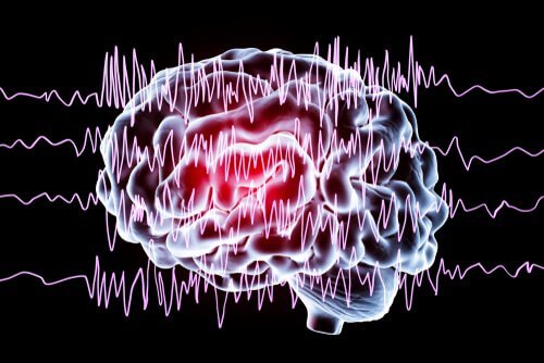 Cérebro em crise epiléptica