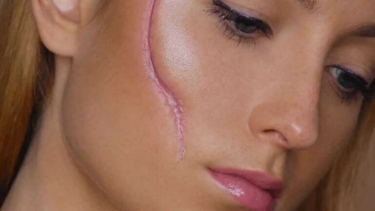 Mulher com cicatriz no rosto