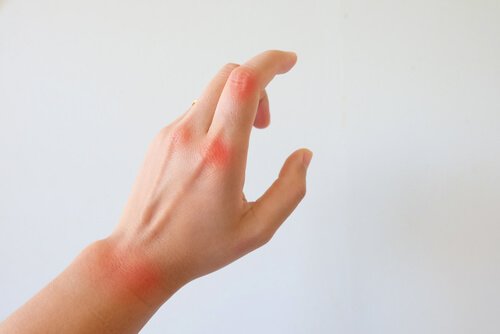 Relação entre emoções negativas e artrite reumatoide