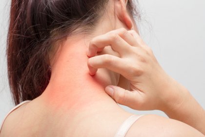 6 conselhos para tratar a dermatite atópica - A Mente é Maravilhosa