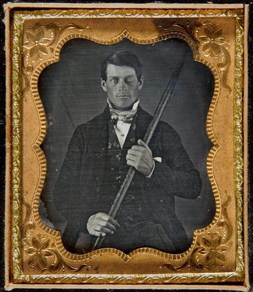Retrato de Phineas Gage