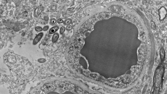 Microbioma cerebral: bactérias intestinais no cérebro humano
