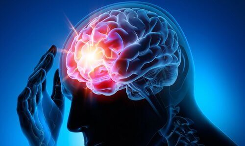 Como prevenir o aneurisma cerebral