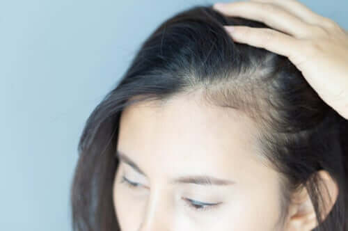 Implicações psicológicas da alopecia em mulheres