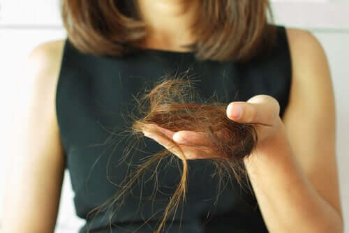 Mulher com muita queda de cabelo