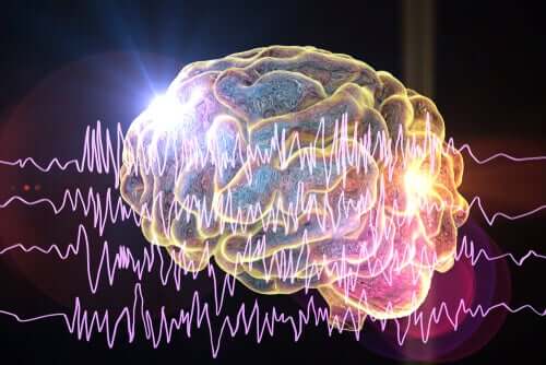 Cérebro com auras epilépticas