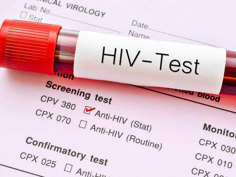 Teste de HIV
