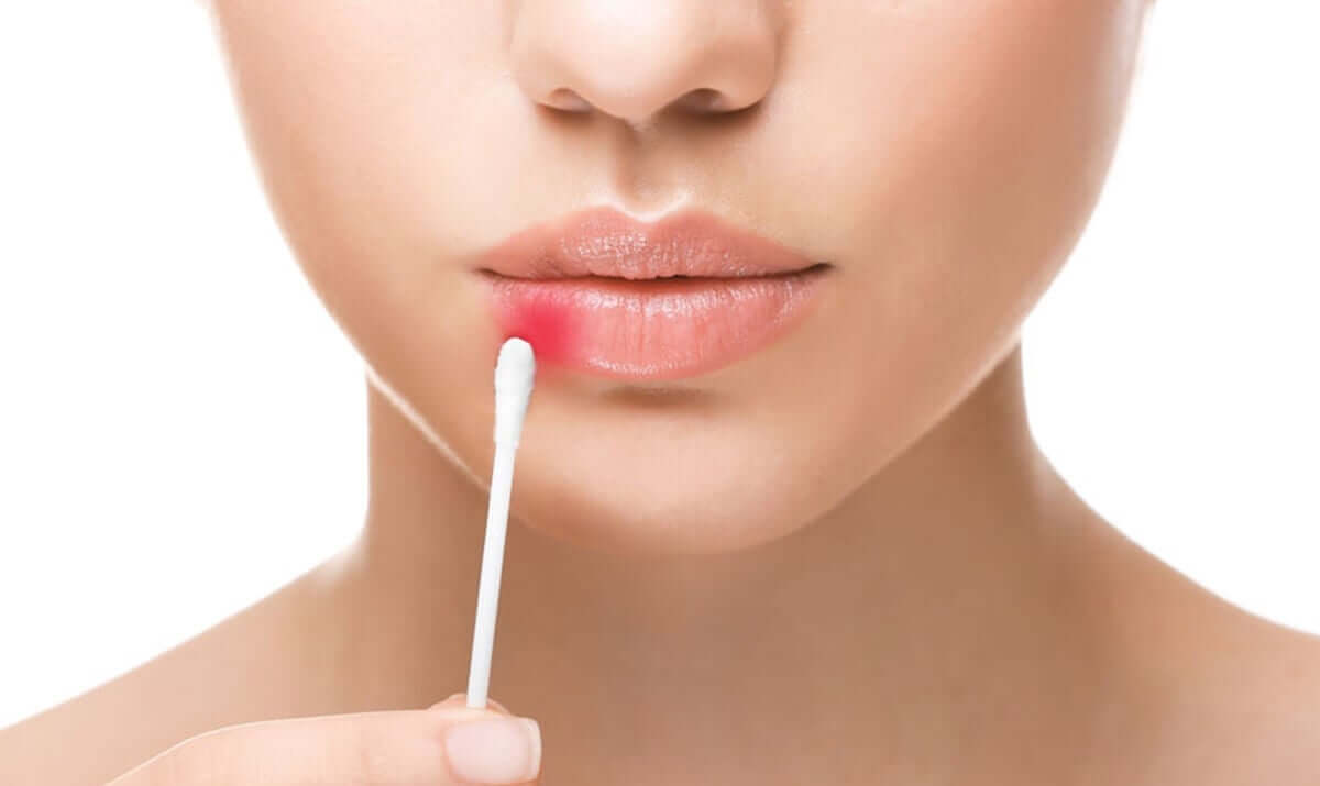 Herpes zoster e transtornos do humor