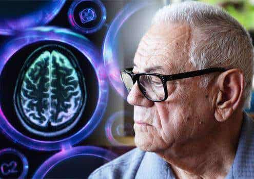 Homem com demência vascular